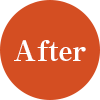 アフター